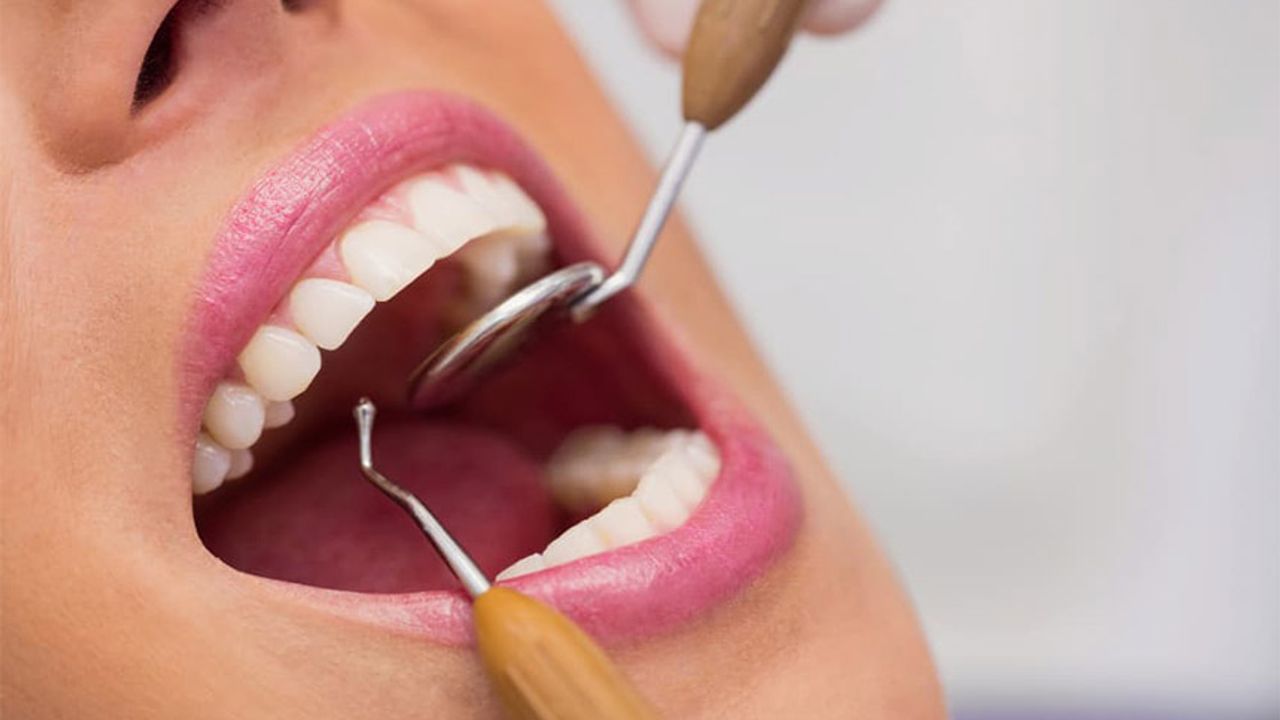 20’lik diş herkesi farklı etkileyebilir